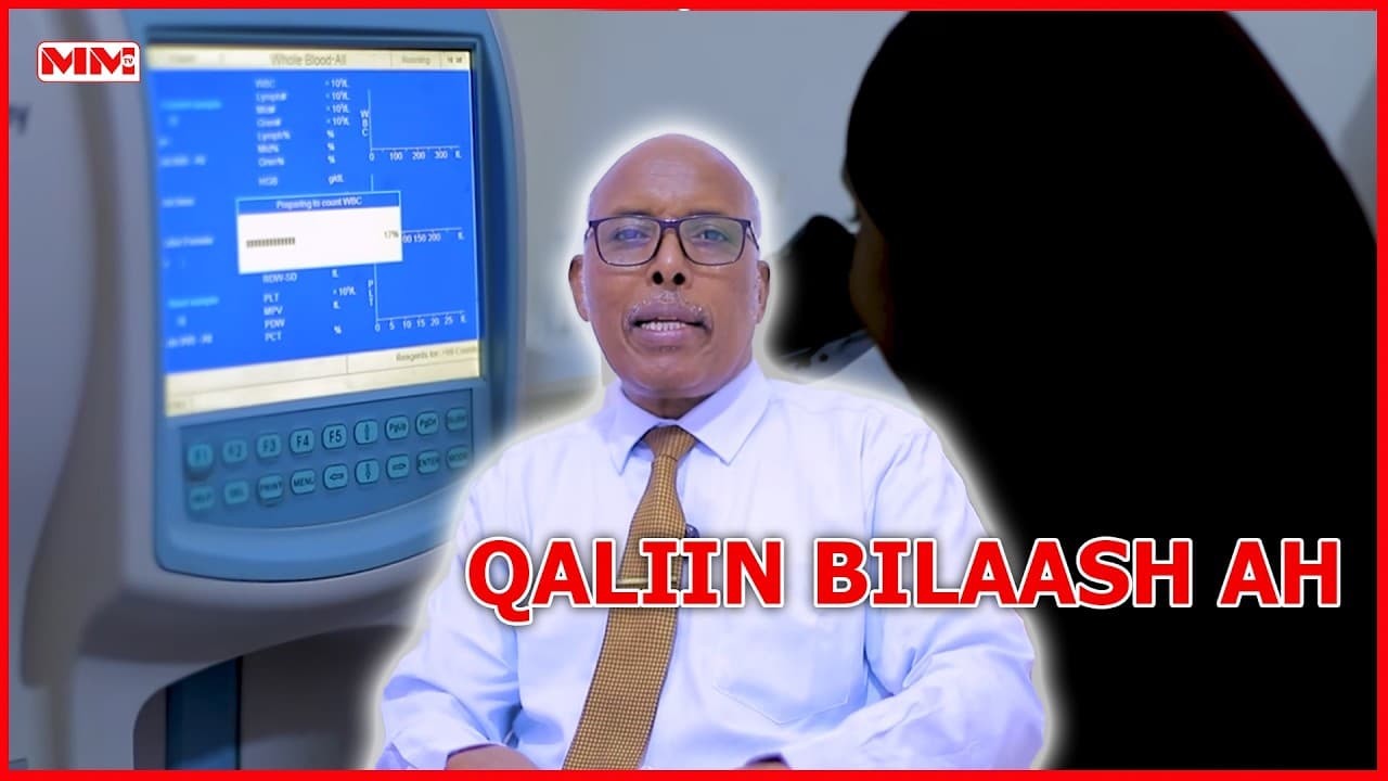Cusbitaalka Madina Hospital oo fulinaya qaliimo lacag la’aan ah.